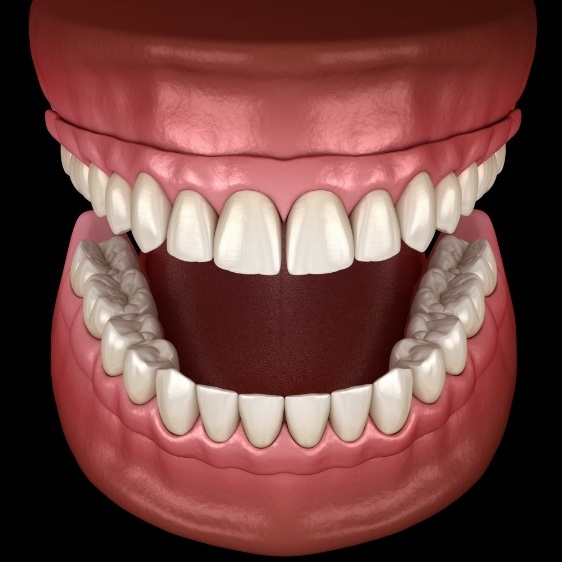 Animated smile with dentures
